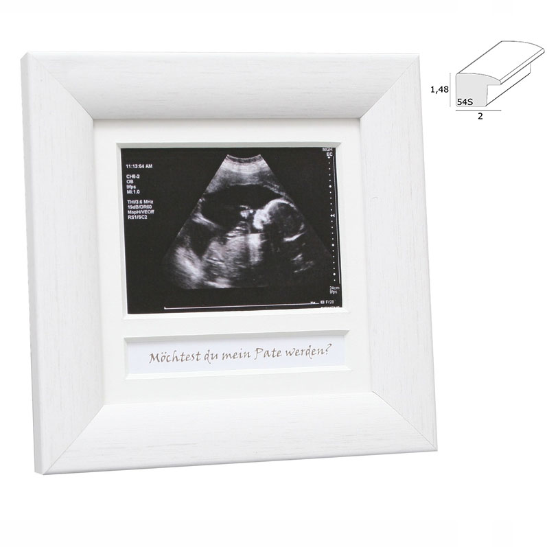 Fotorámeček na ultrazvukový snímek 
